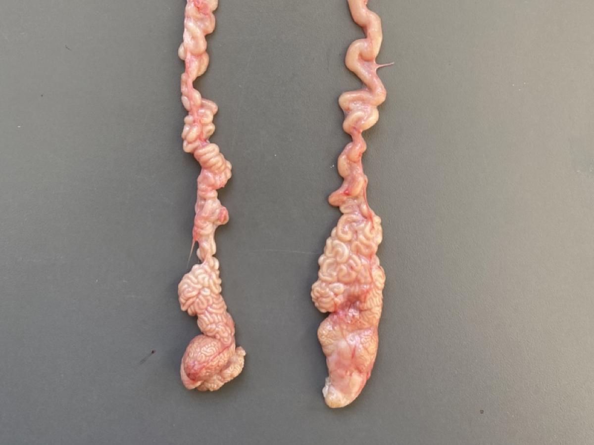 epididymes