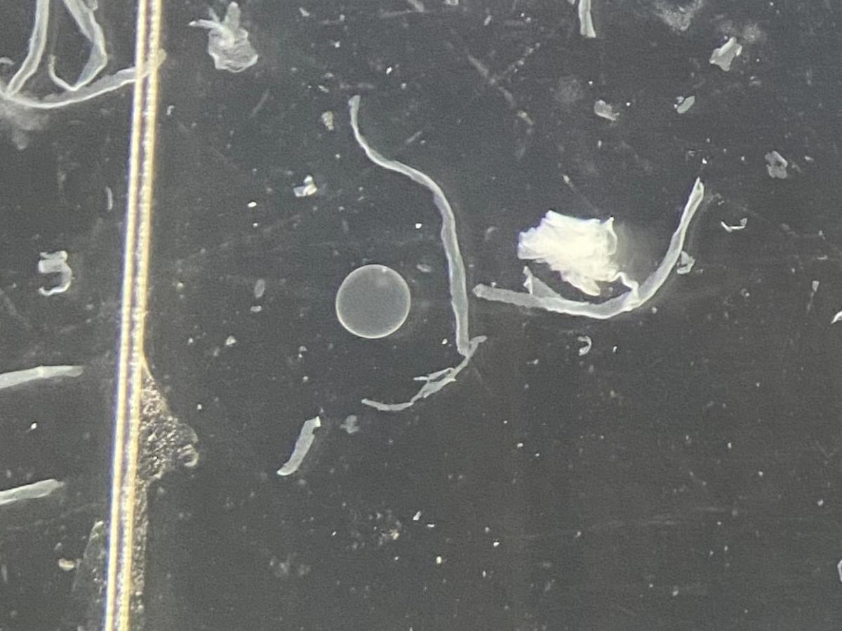 Embryo transfer